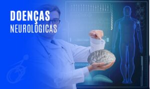 Os Principais Problemas que Levam Pacientes ao Neurologista Os Principais Problemas que Levam Pacientes ao Neurologista